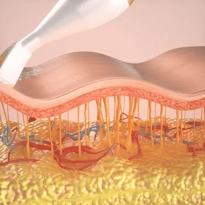 💡 Tout savoir sur la technologie EMS : le secret d’un visage tonique et rajeuni